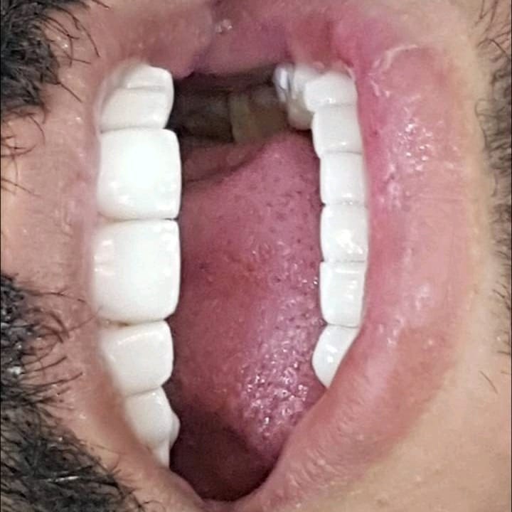 بعد